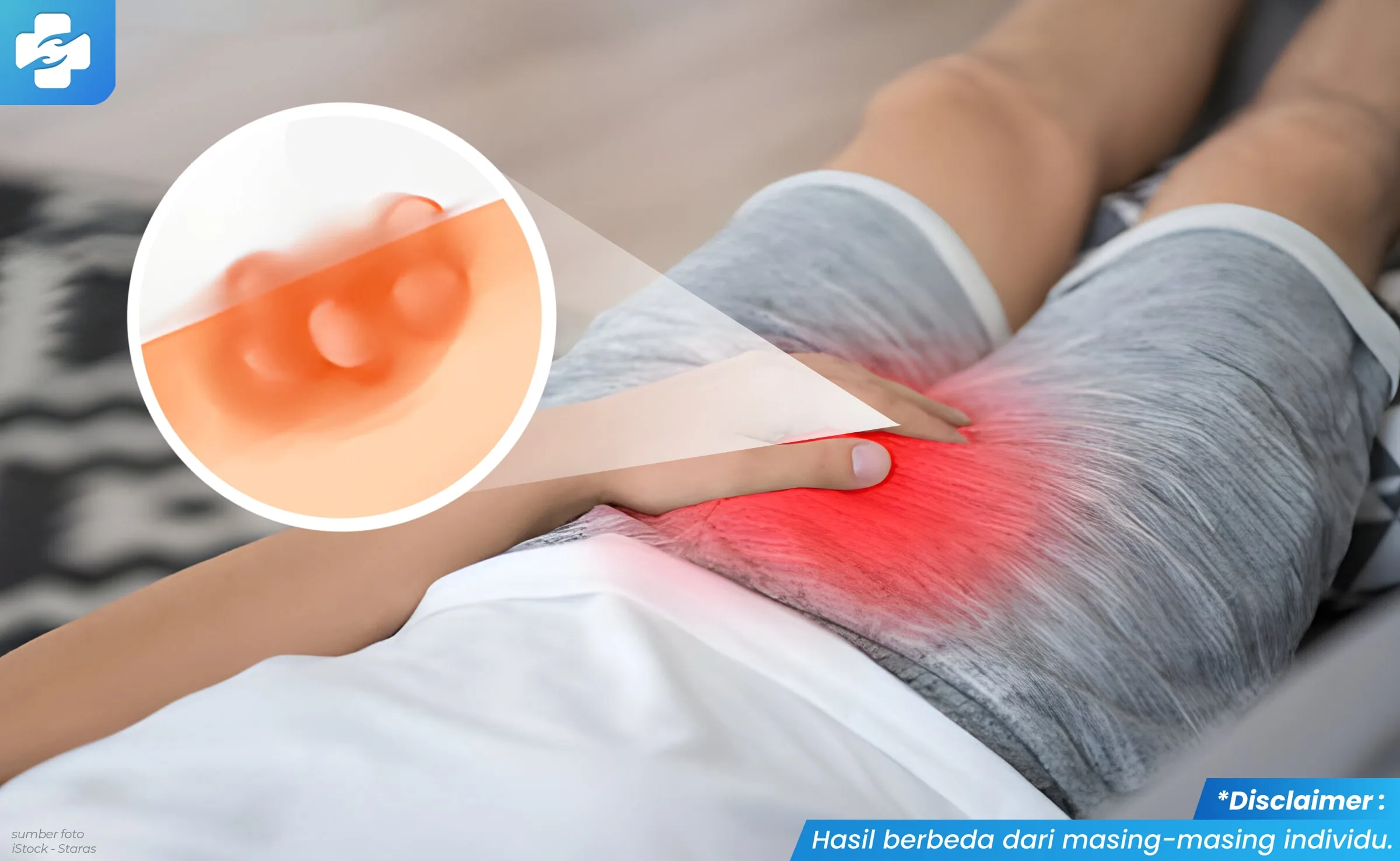 Gambar Kepala Penis Melepuh