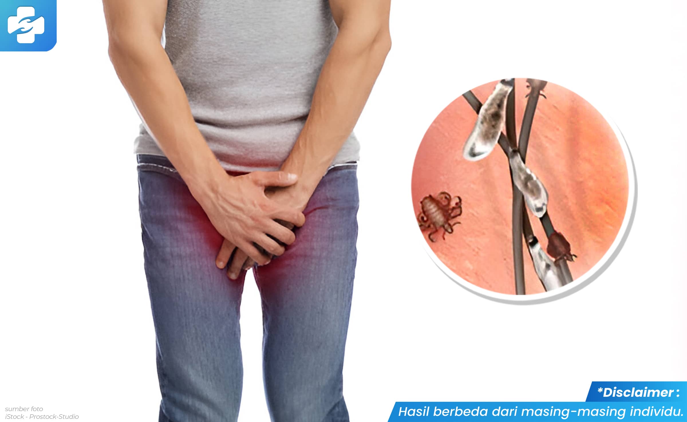 Gambar Kutu di Kelamin