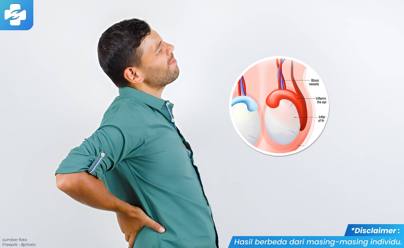 benjolan pada testis 2