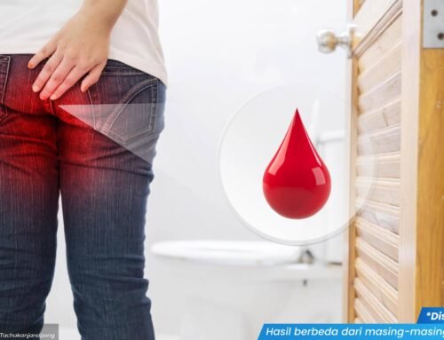 Keluar Darah saat Kencing Tapi Bukan Menstruasi? Waspadai 3 Penyakit Ini!