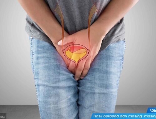 Sering Mengalami Nyeri saat Buang Air Kecil? Sebaiknya Waspadai Kondisi Ini!