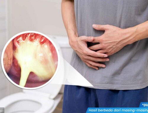 5 Faktor Penyebab Seseorang Terkena Infeksi Klamidia, Jangan Abaikan!