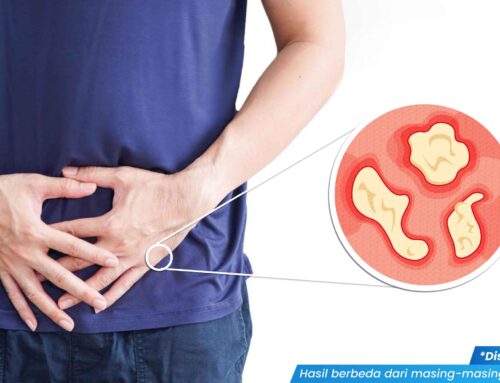 Tak Disangka! Ternyata Luka pada Kulit Penis Bisa Memicu Berbagai Jenis Penyakit Kelamin Lho