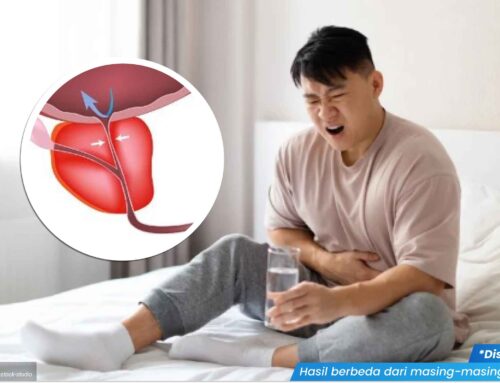 Diam-Diam Menyerang! Kenali Gejala Awal Masalah Prostat pada Pria