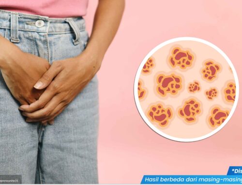 Waspada! Ini 5 Tanda dan Bahaya Infeksi HPV pada Wanita