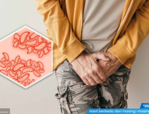 Makin Parah! Ini Dia Tingkat Keparahan Kutil Kelamin yang Perlu Kamu Waspadai