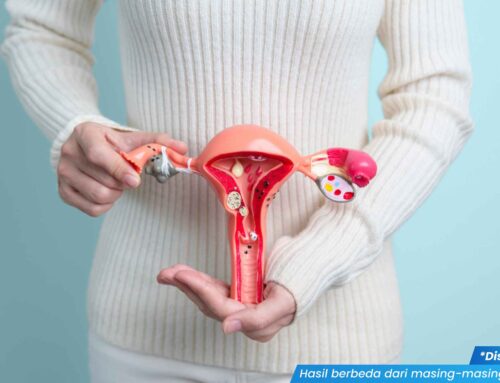 Ancaman Senyap! Begini Tanda Gonore Parah pada Wanita dan Bahayanya