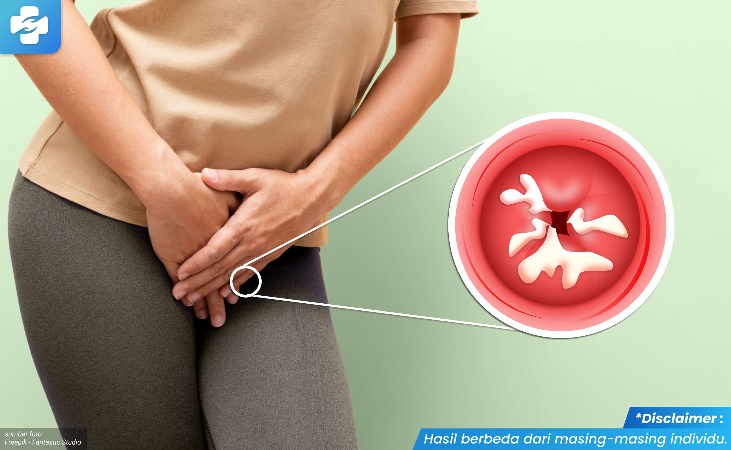 obat keputihan gatal 1_3_11zon