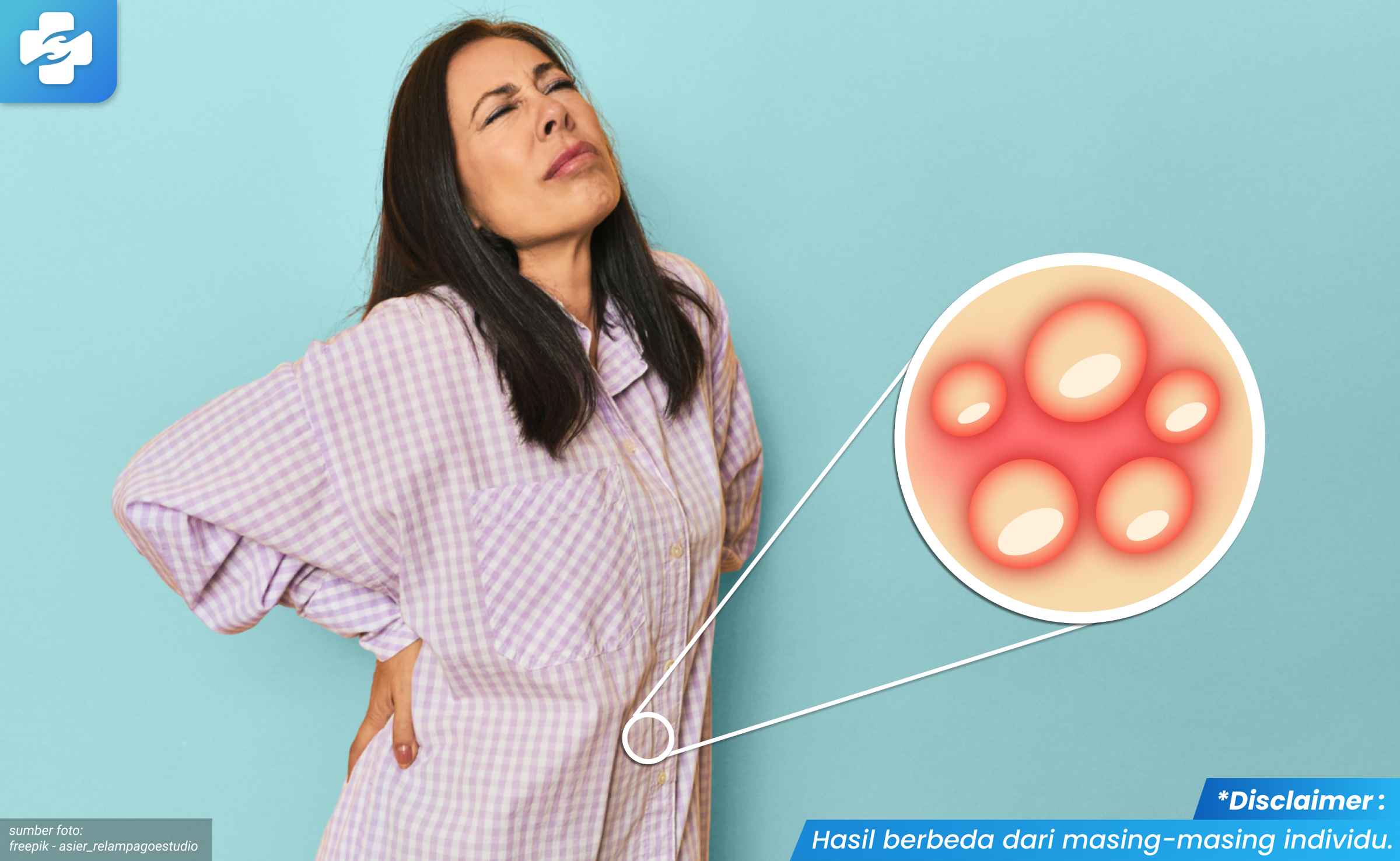 herpes genital sudah sembuh 1_2_11zon