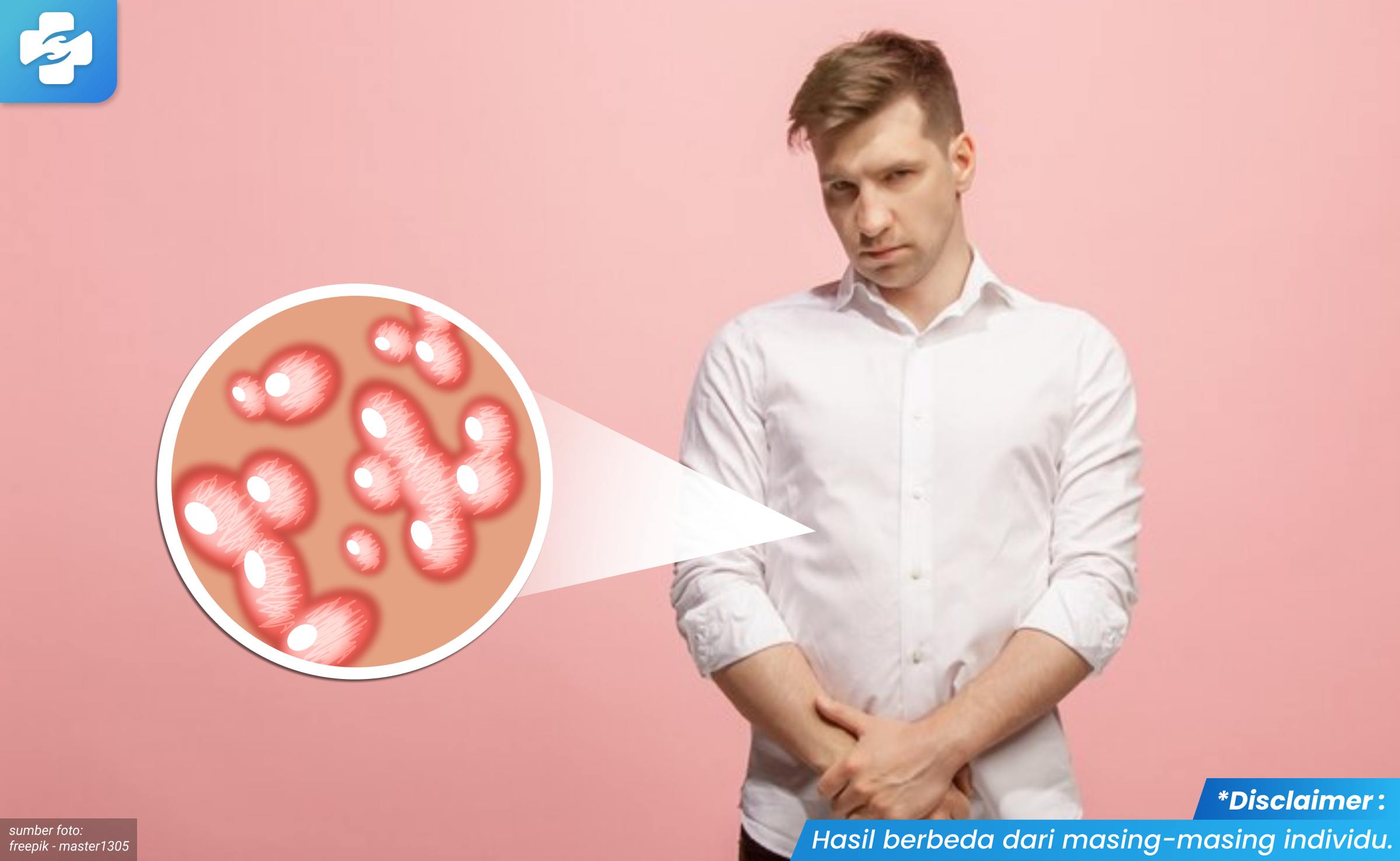 bentuk kutil di kelamin pria 1_3_11zon