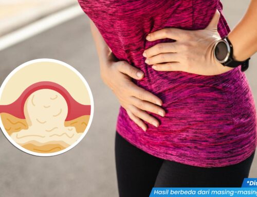 Sangat Menyakitkan! Ini Dia Penyebab Bisul di Bibir Vagina yang Perlu Anda Waspadai