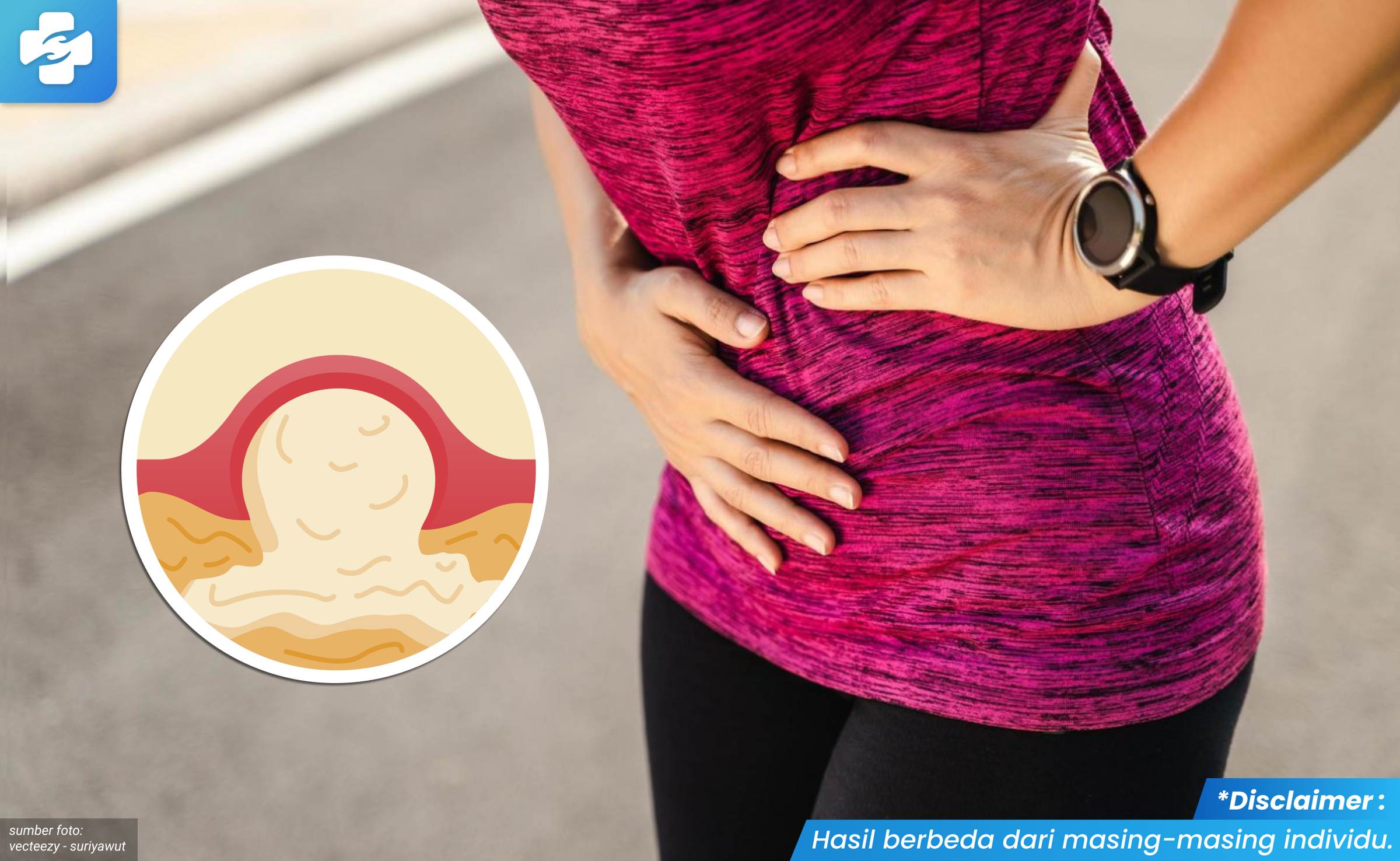 bisul di bibir vagina 1_1_11zon