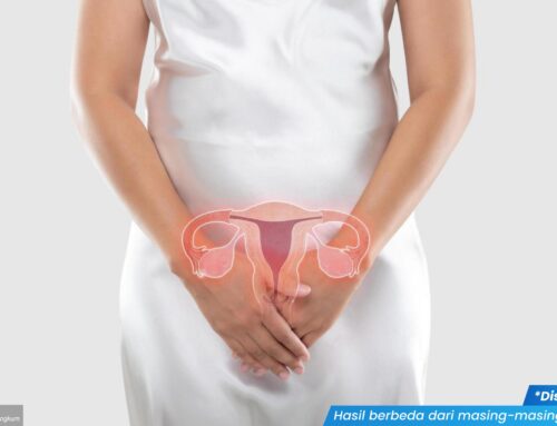 Jangan Sembarangan, Ini Obat Sariawan Kelamin yang Tepat Sesuai Penyebabnya!