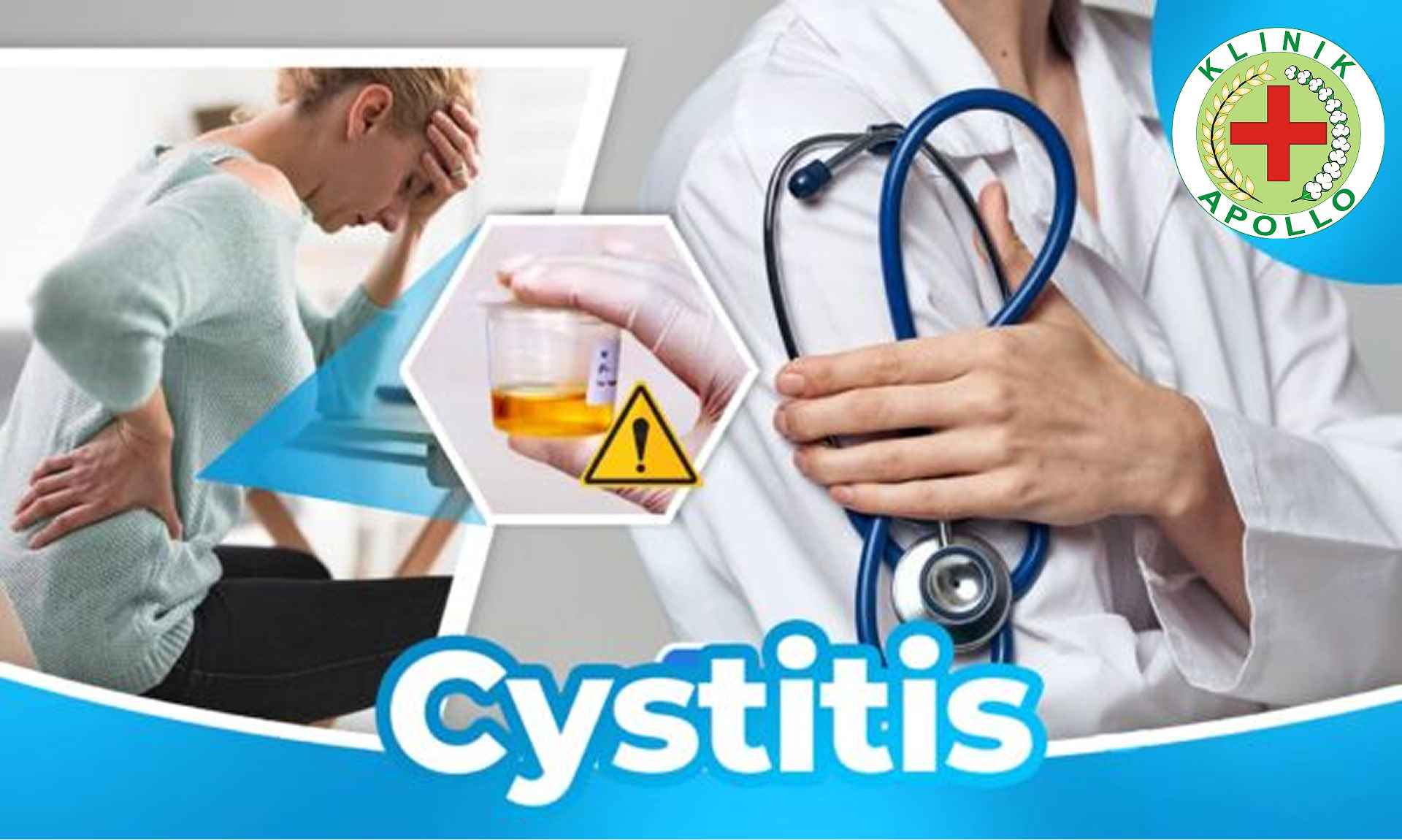 Cystitis