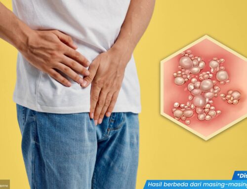 Lepuh Gatal di Kelamin Tidak Kunjung Sembuh? Dokter Ahli Ungkap Penyebab dan Solusinya