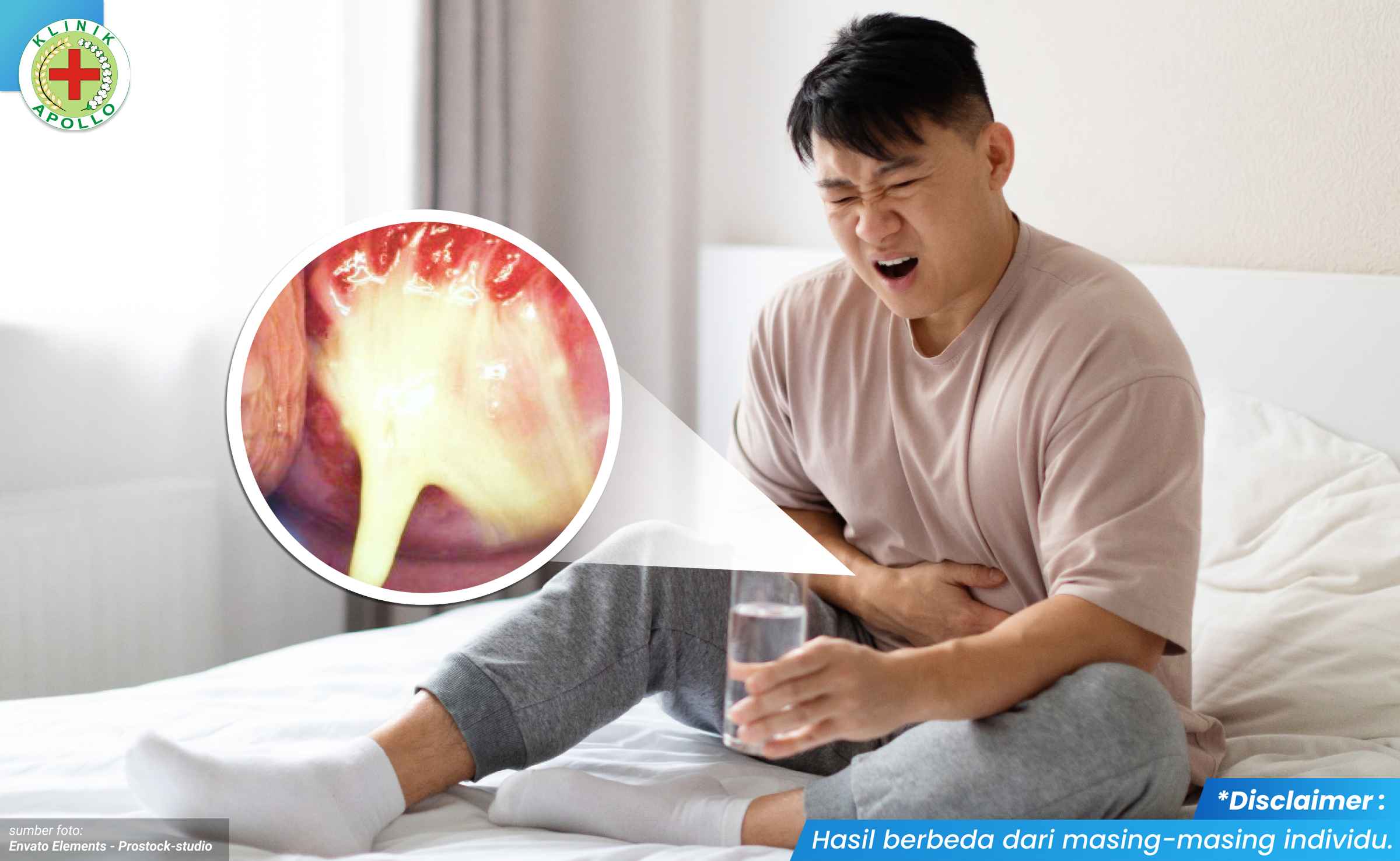 ciri penyakit gonore 1_1_11zon