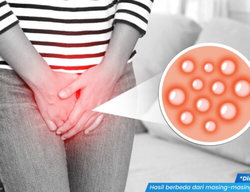Kemaluan Wanita Gatal Bikin Tidak Nyaman? Ini Cara Aman Mengatasinya