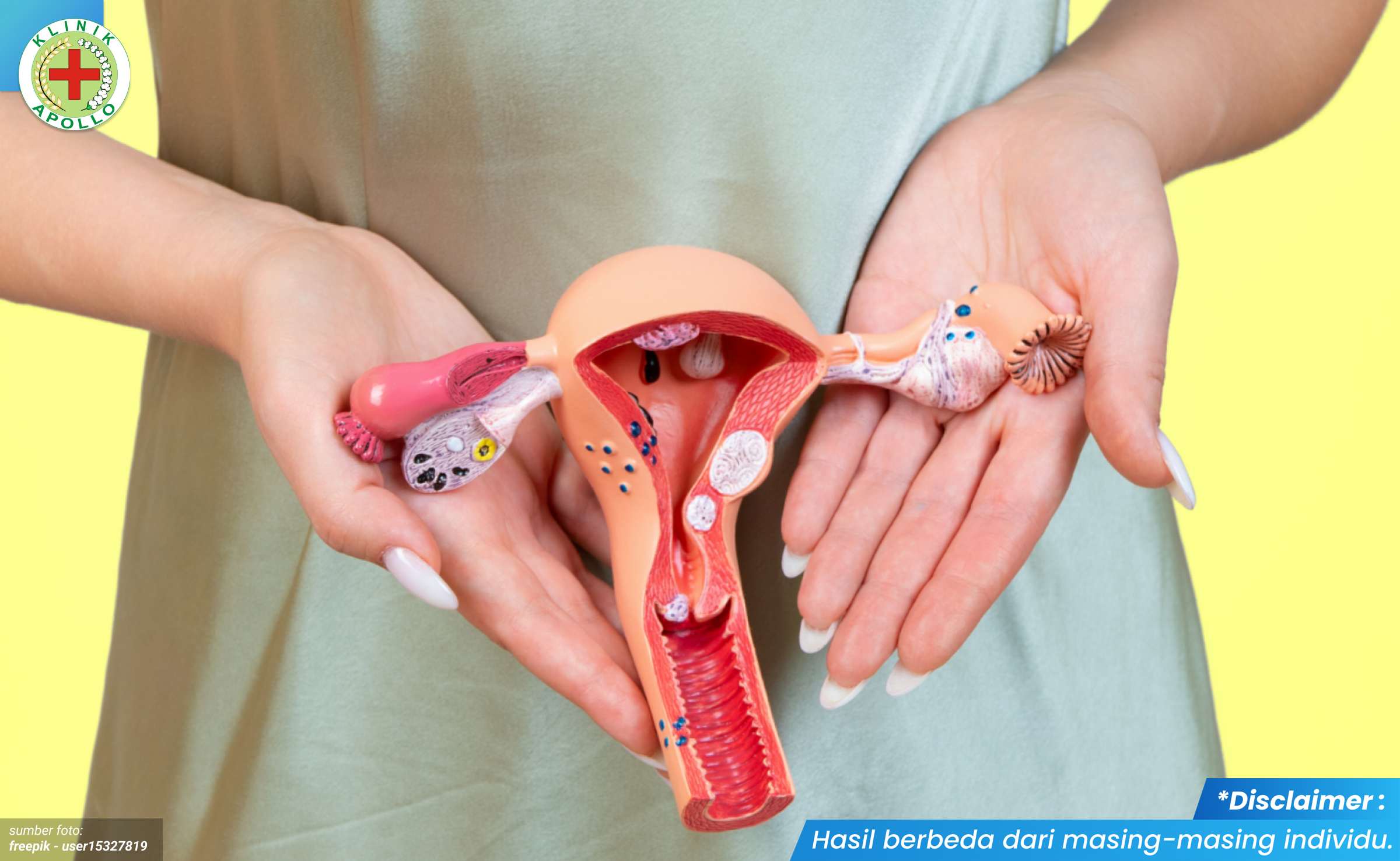 kemaluan keluar nanah bau 1_1_11zon