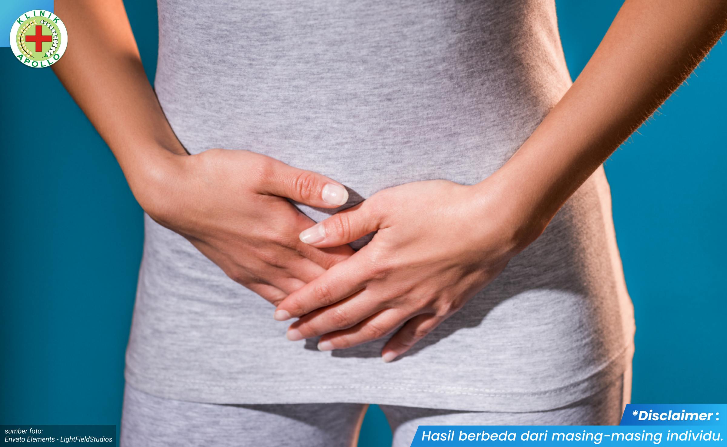 kista bartholin berdarah 1_1_11zon