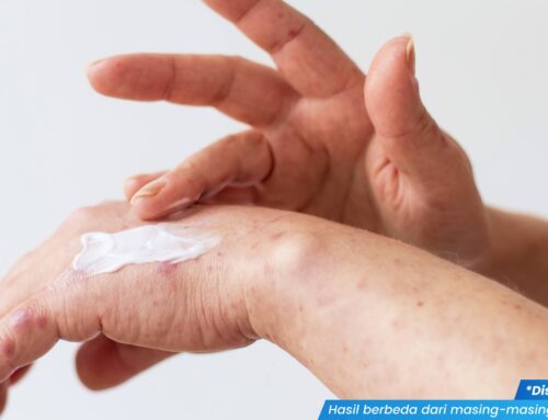 Cek Sebelum Beli! Salep Herpes di Kelamin di Apotek, Ampuh atau Cuma Redakan Gejala?