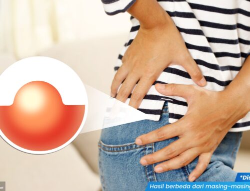 Jangan Dipencet! Benjolan Lunak di Vagina Bisa Jadi Tanda Kista Bartholin