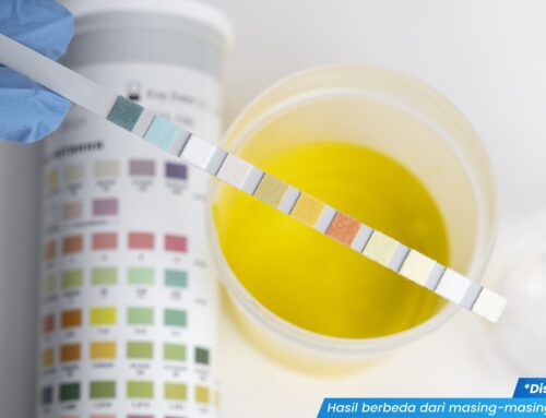 Jangan Panik! Buang Air Kecil Keluar Cairan Kuning, Ini Penjelasan Medisnya