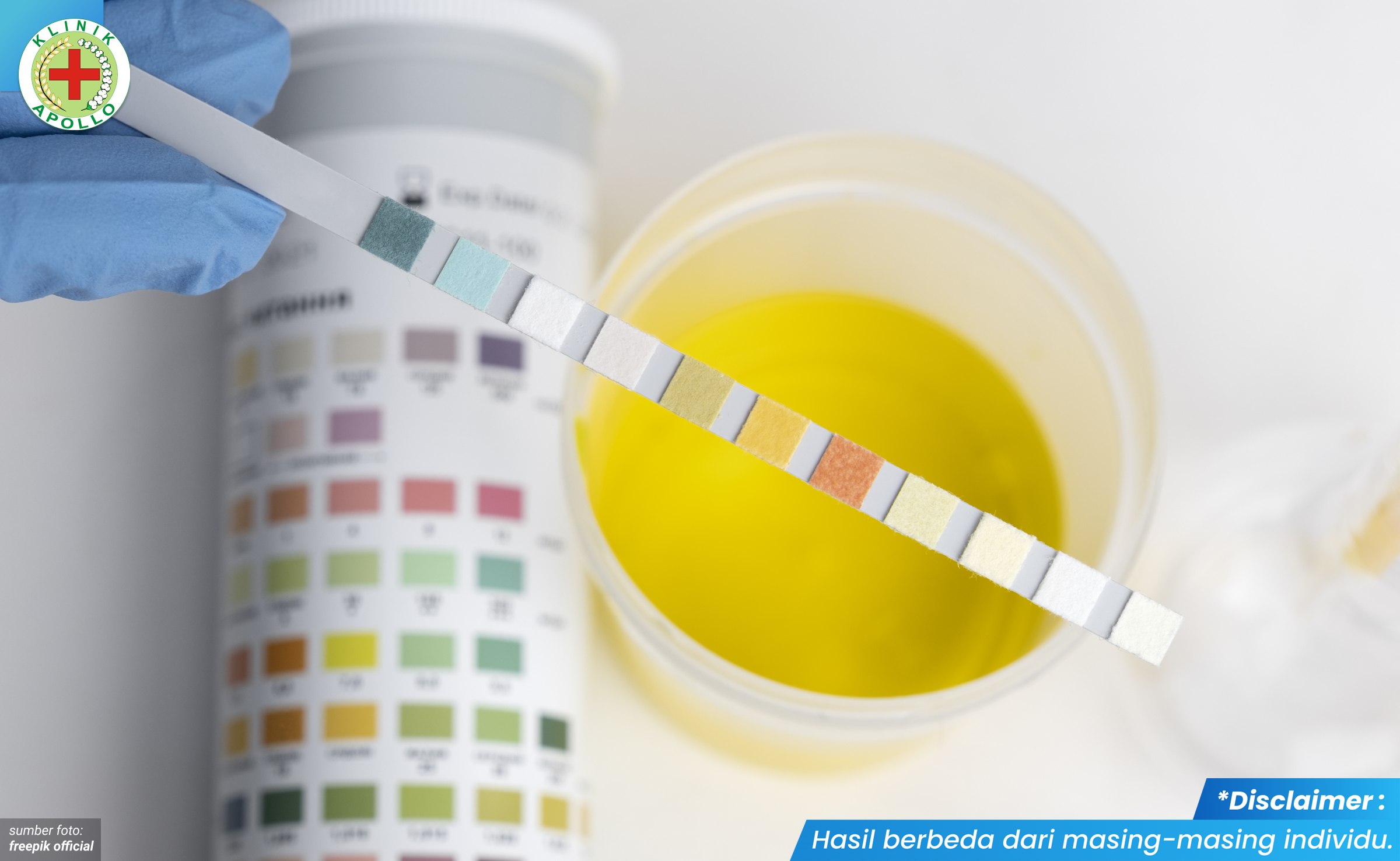 buang air kecil keluar cairan kuning 1_4_11zon