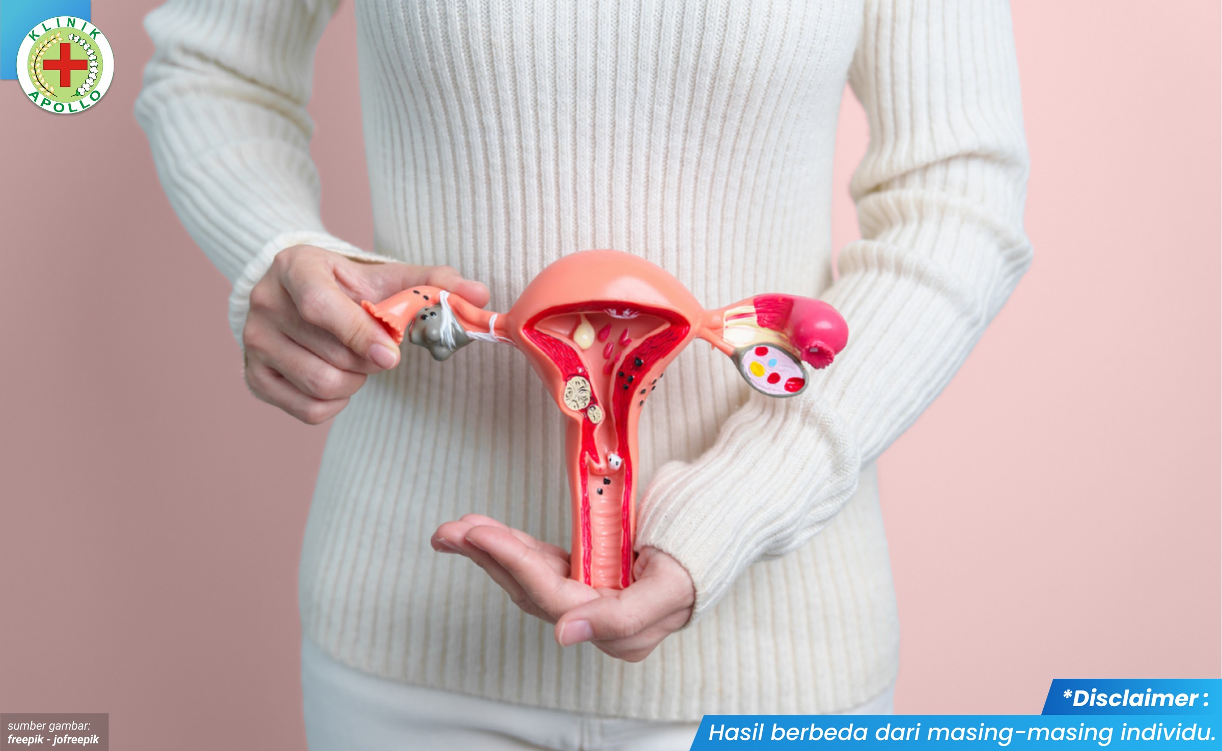 cara agar vagina tidak bau 2_2_11zon