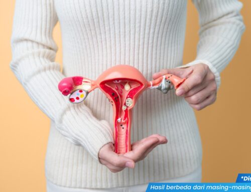 Tidak Gatal Tapi Kok Menular? Waspada, Ini Gejala Penyakit Jengger Ayam!