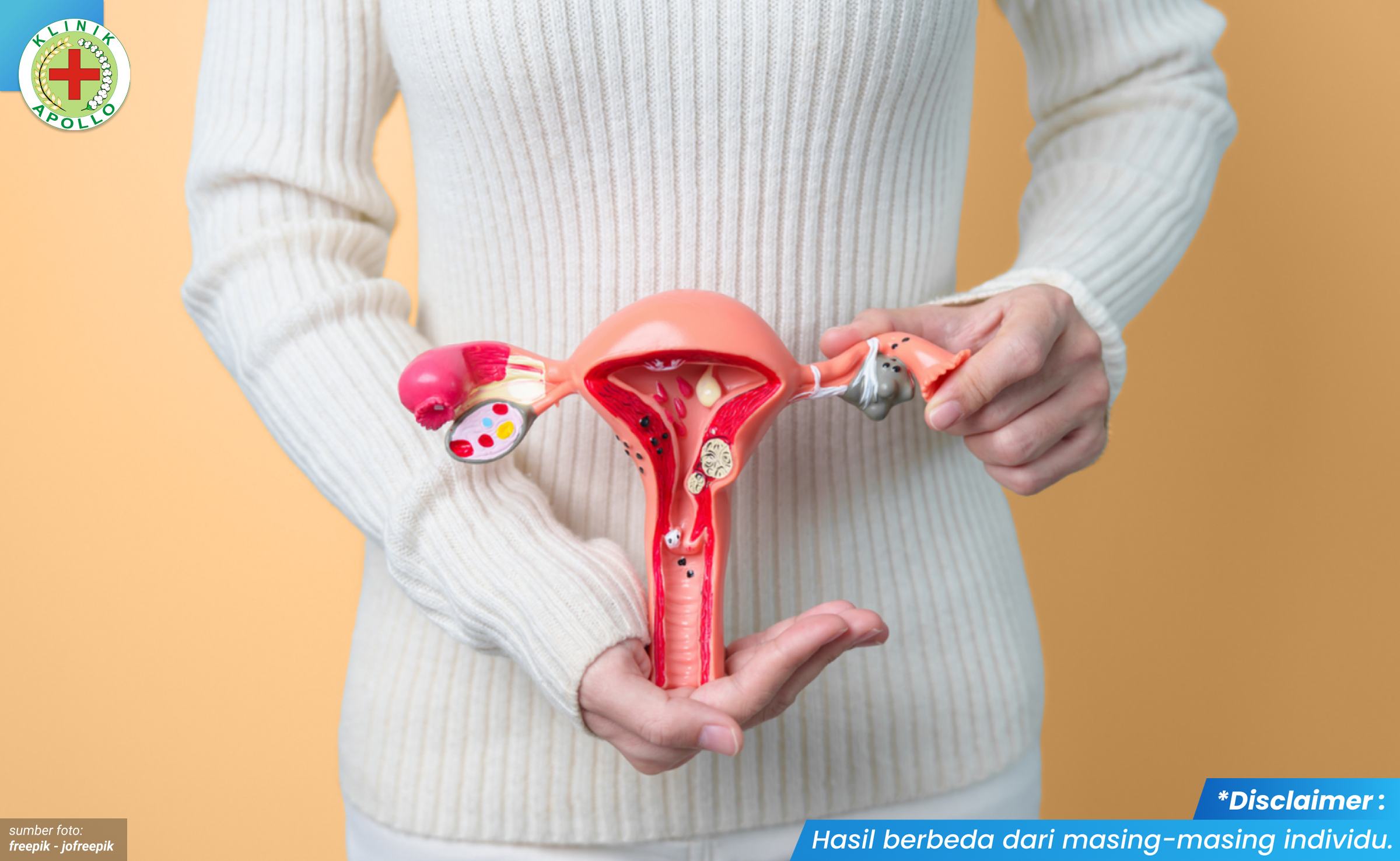 gejala penyakit jengger ayam 1_1_11zon