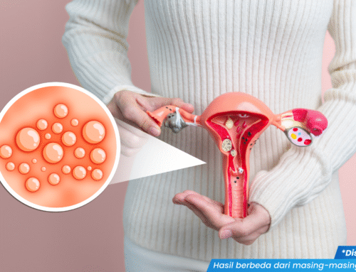 Sering Kambuh! Ini Penyebab Herpes Genital pada Wanita Sulit Sembuh