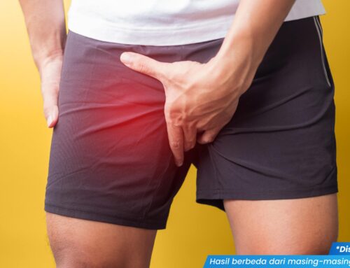Waspada! Keluar Nanah dari Kelamin Pria Bisa Jadi Gejala Infeksi Menular Seksual