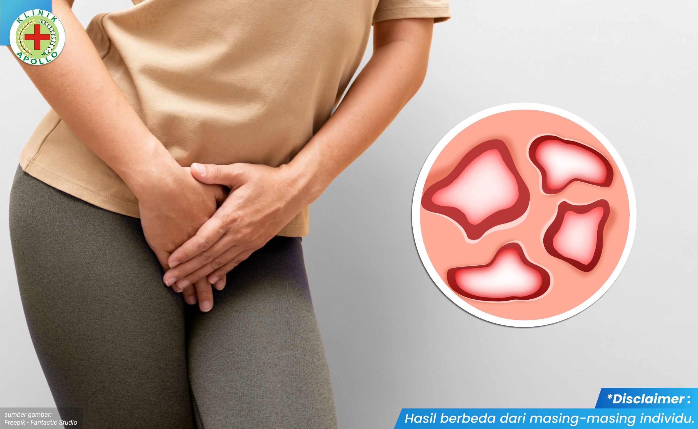 luka pada kelamin 2_4_11zon