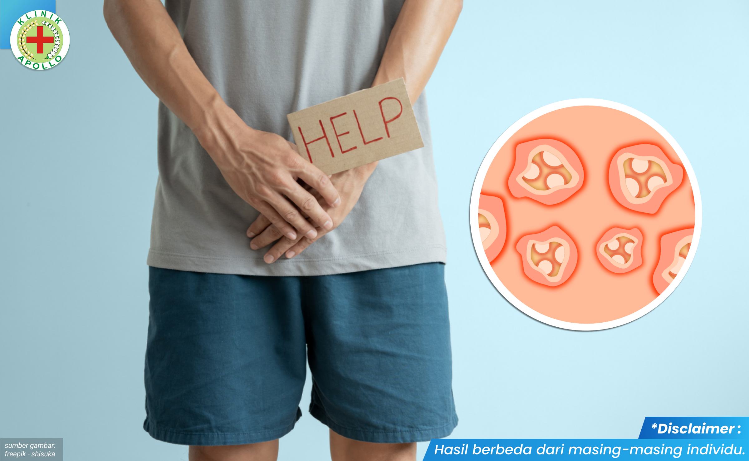 obat kutil kelamin paling ampuh 2_5_11zon