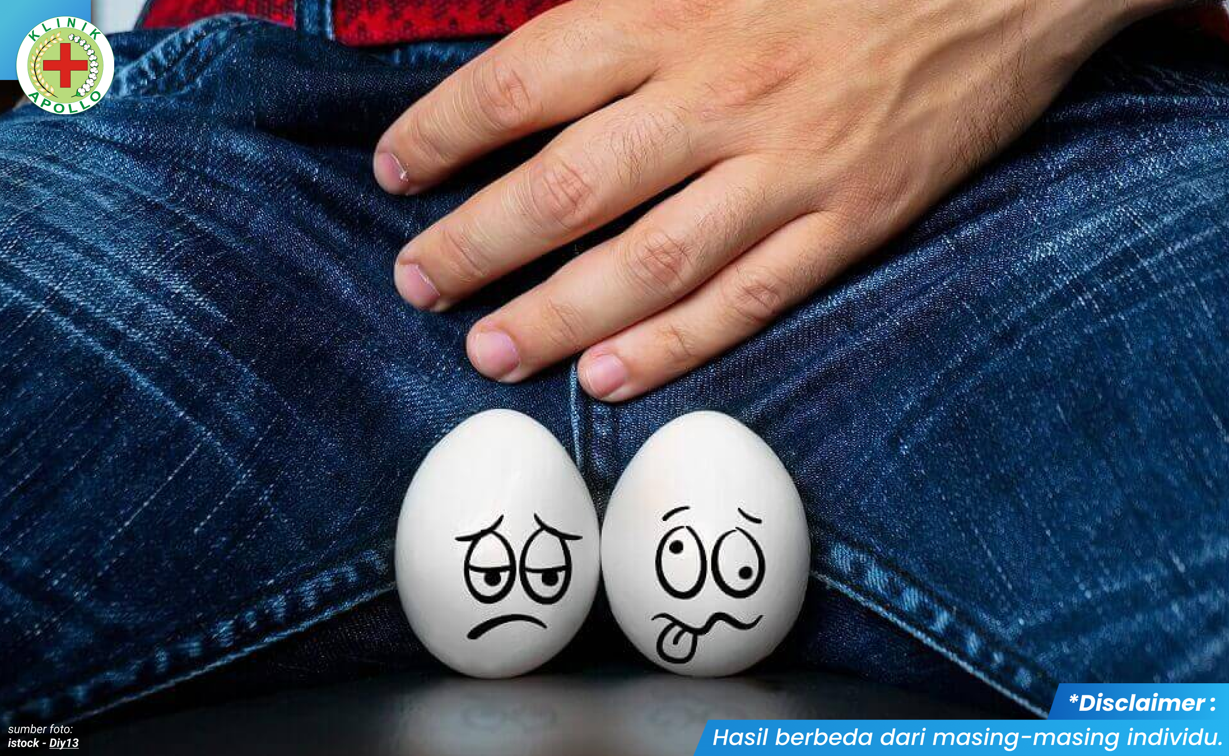 benjolan di kantung testis 1 - kliniksentosajakarta.com