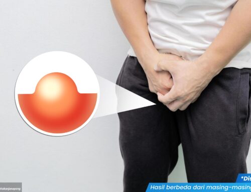 Tak Selalu Sakit, Tapi Berisiko! Benjolan di Kelamin Pria Bisa Jadi Tanda Infeksi Serius