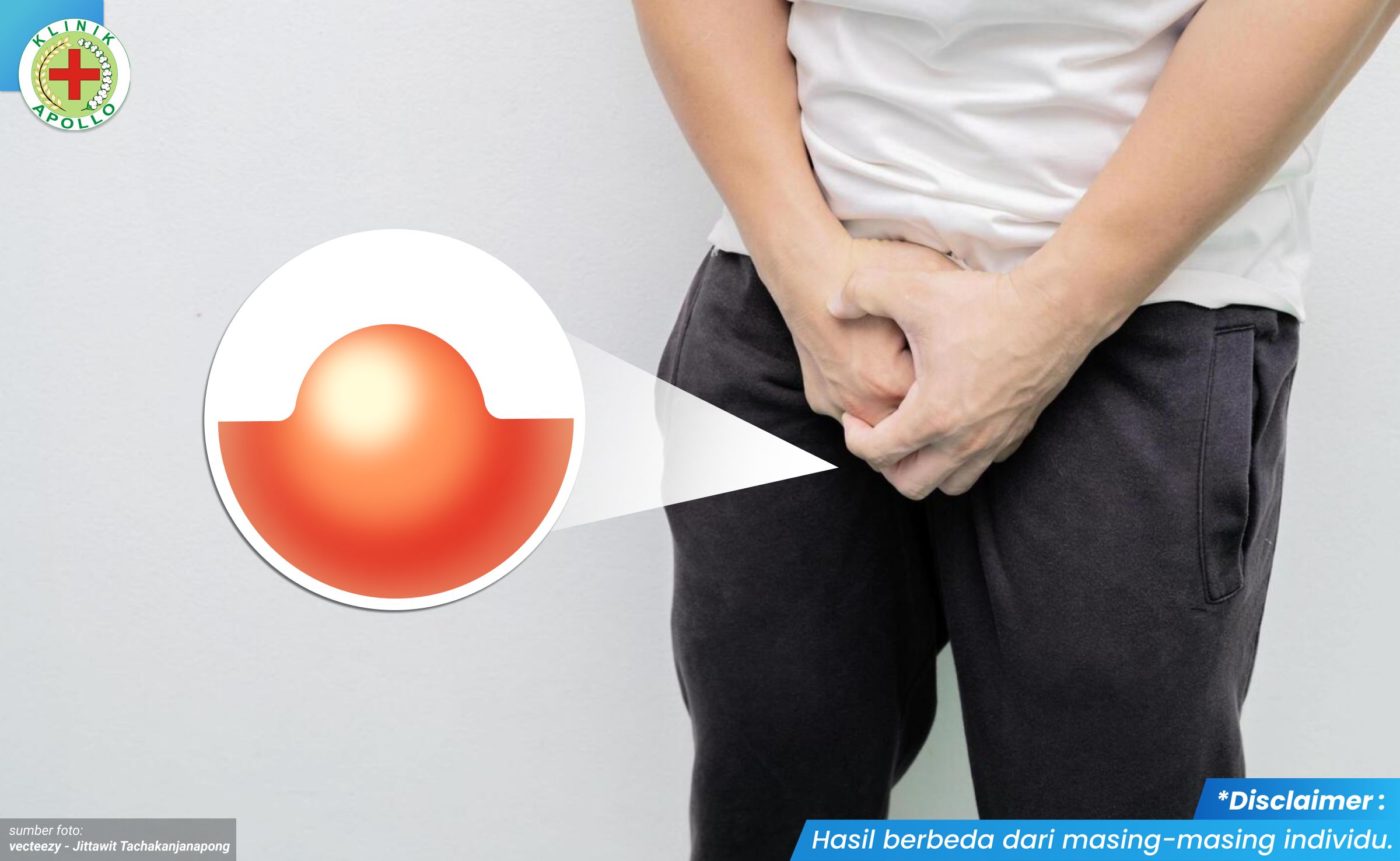 benjolan di kelamin pria 1_3_11zon