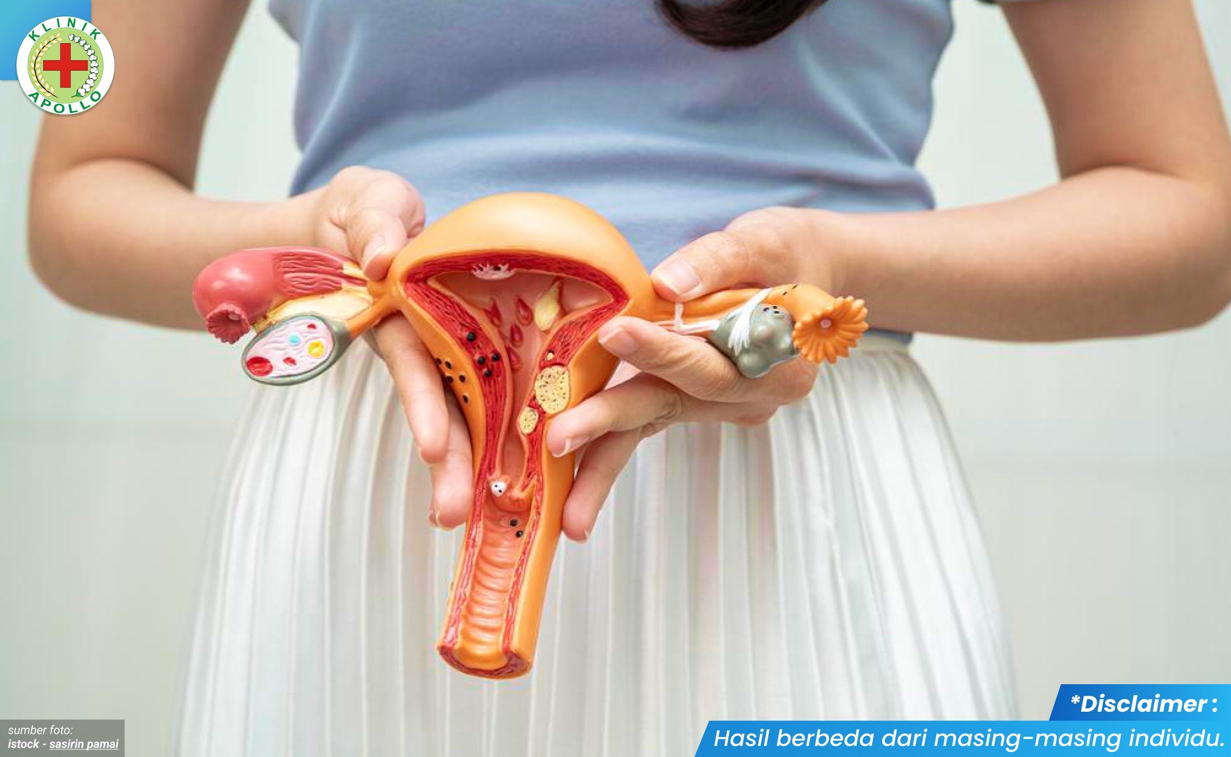 kutil vagina 1 - kliniksentosajakarta.com_3_11zon