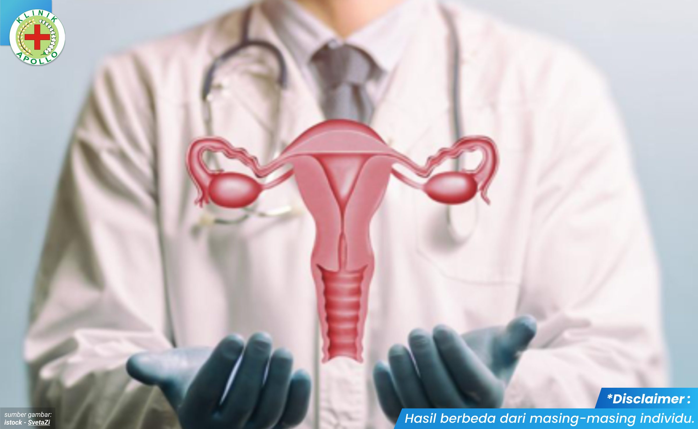 kutil vagina 2 - kliniksentosajakarta.com_4_11zon