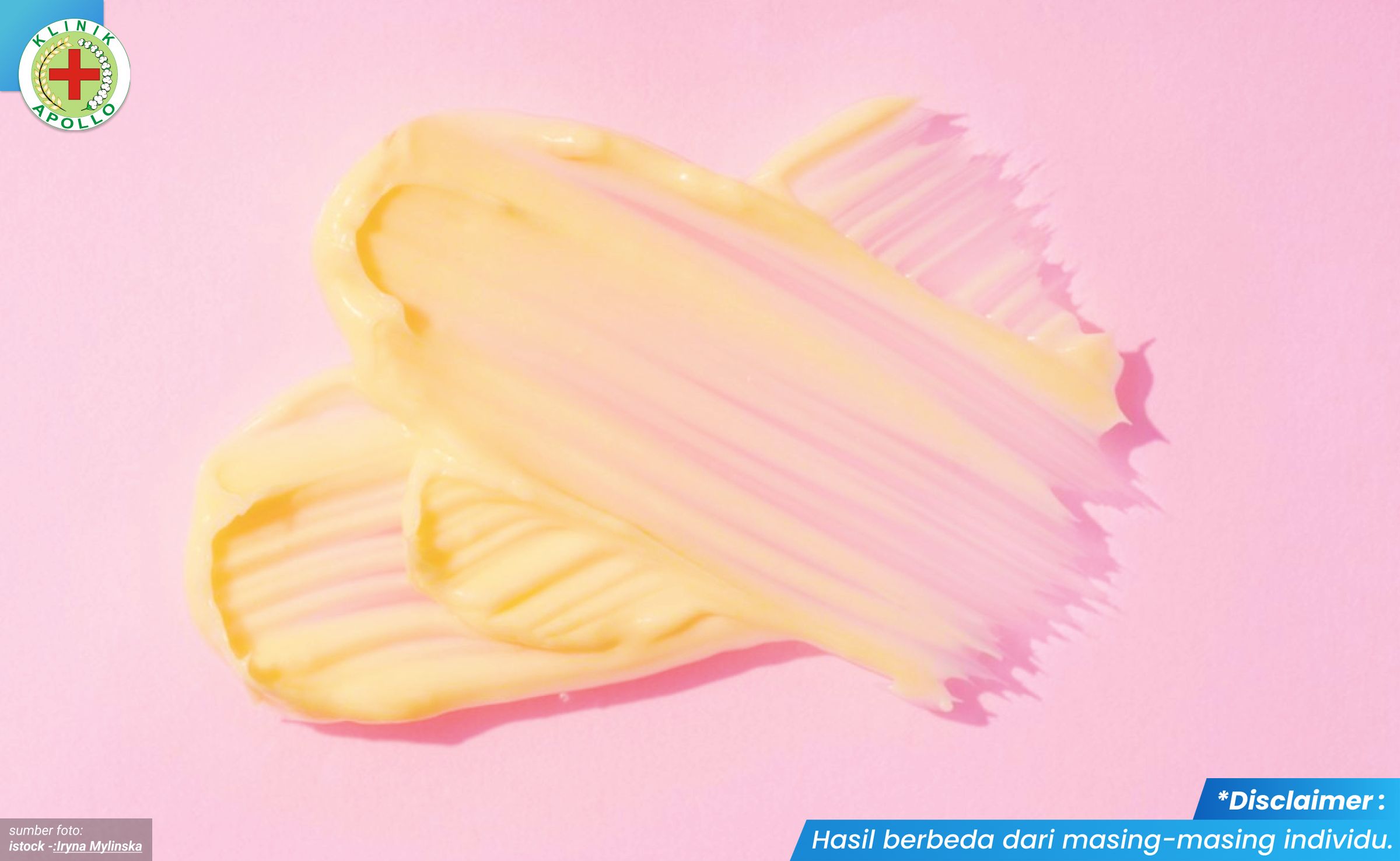 mengobati keputihan berwarna kuning 1 - kliniksentosajakarta.com_2_11zon