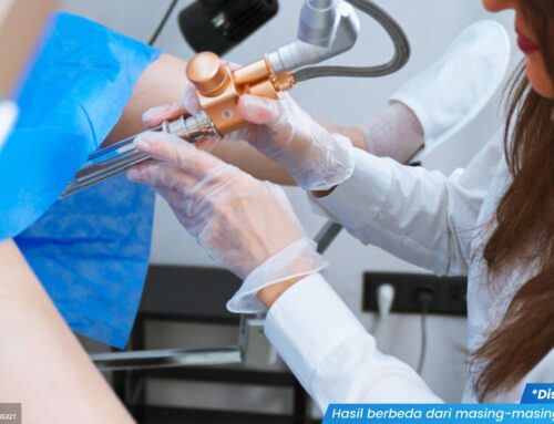 Peradangan Serviks Berbahaya? Deteksi Lewat Pemeriksaan Pap Smear!