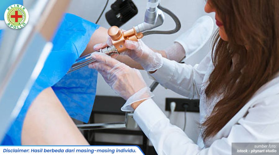 pemeriksaan pap smear 1_2_11zon