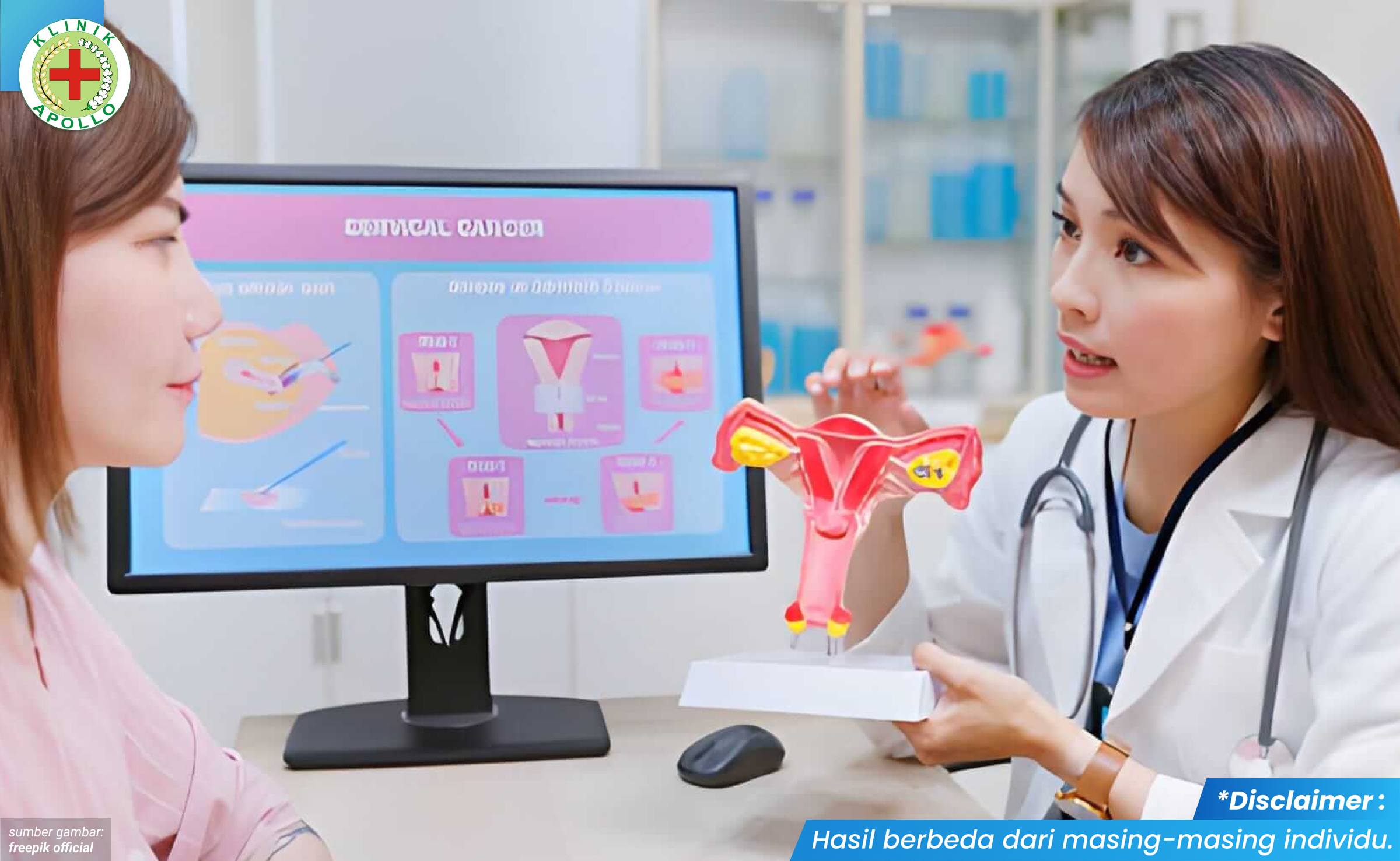 pemeriksaan pap smear 2_3_11zon