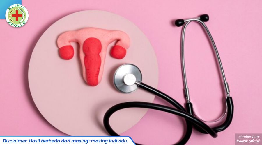 pemeriksaan pap smear 2_3_11zon