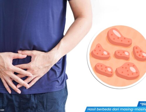 Benjolan di Area Mr P Setelah Berhubungan, Benarkah Tanda Infeksi Menular? Waspada!