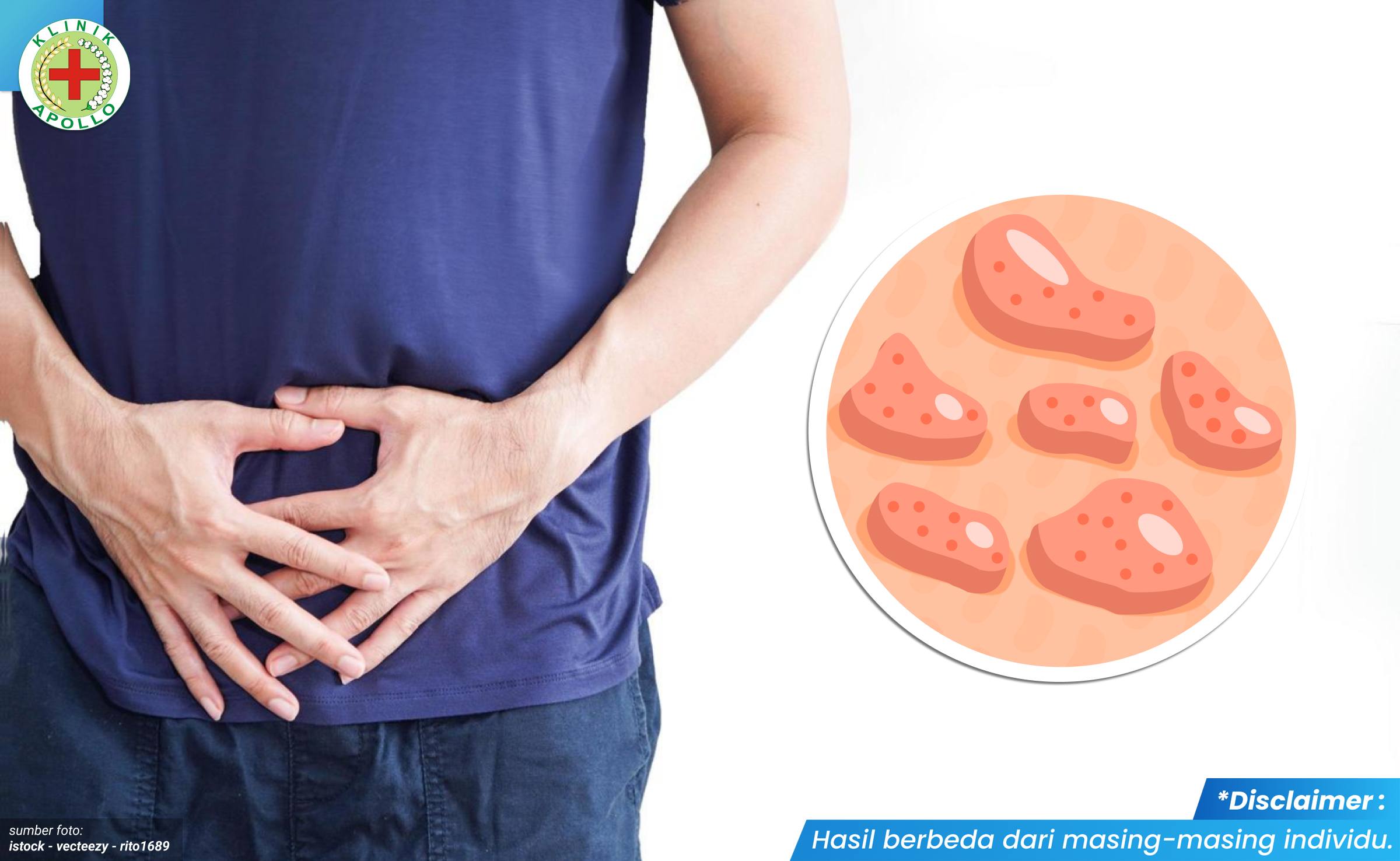 benjolan di area mr p 1_1_11zon