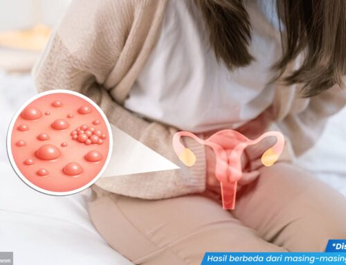 Tiba-Tiba Ada Bintik Merah di Vagina, Normal atau Tanda Bahaya? Wanita Wajib Tahu Penyebabnya!