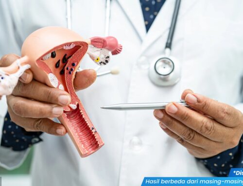 Tips Ampuh Mengatasi Kondiloma Akuminata pada Wanita Sebelum Parah, Cek di Sini!