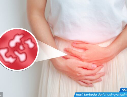 Pentingnya Mengatasi Penyakit Sifilis Sejak Dini untuk Cegah Dampak Jangka Panjang, Cek!