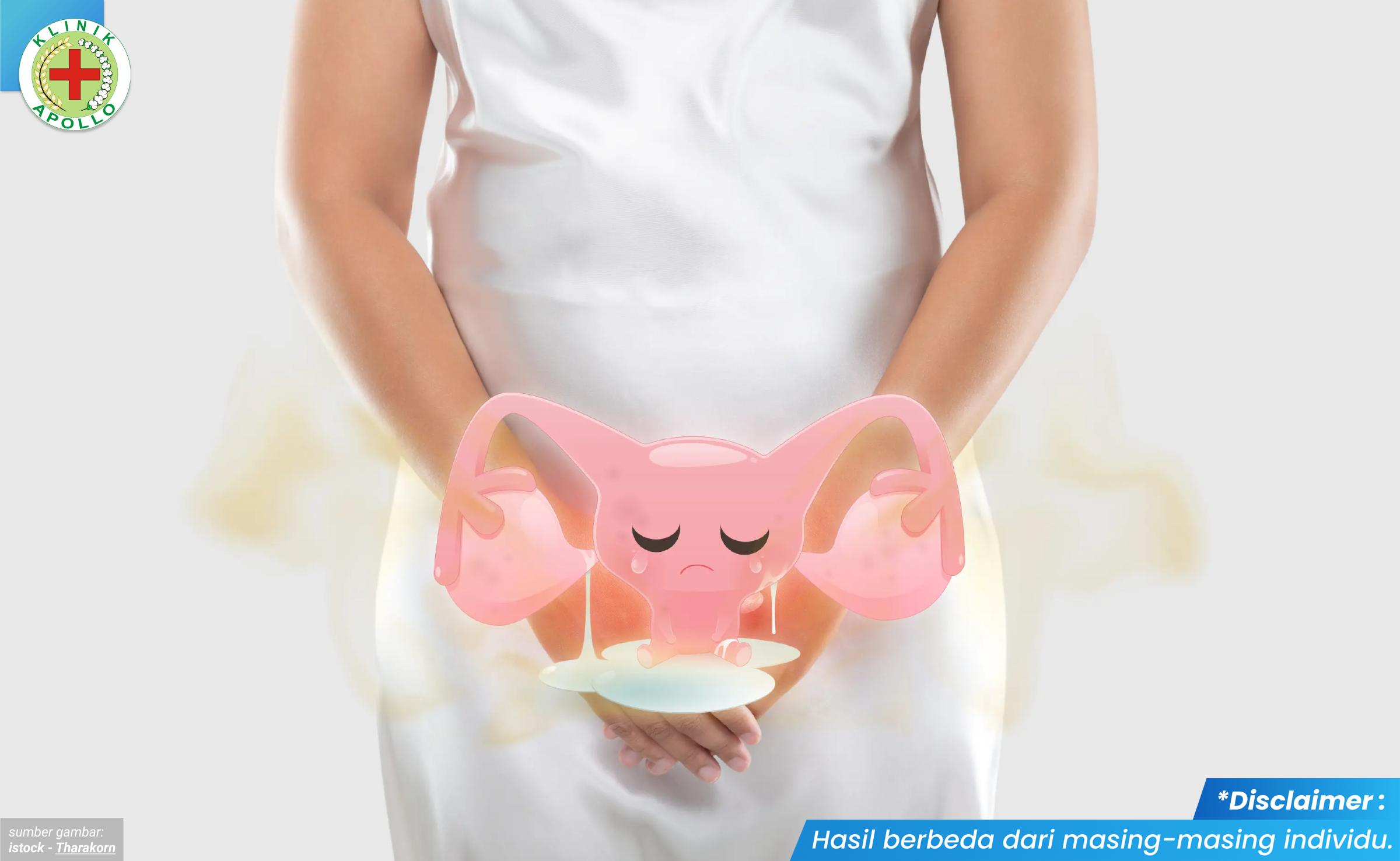 obat keputihan gatal 2_6_11zon